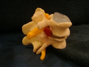 脊骨出現退化，軟骨脫水令兩節退化的椎骨距離變近，令後端的脊骨神經受壓，增加坐骨神經痛的徵狀