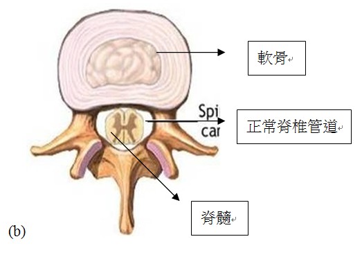 脊椎管道的結構