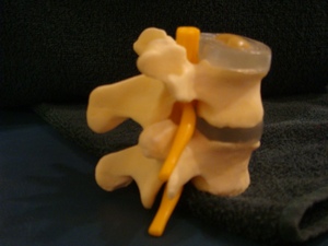 正常的椎骨距離，位於後端的脊骨神經在椎間孔通過來管埋身體不同部位